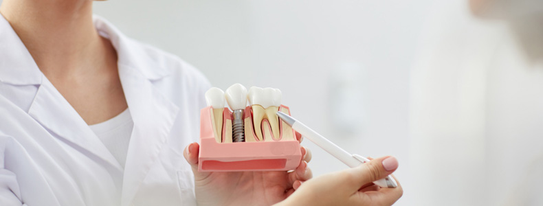 İmplant Tedavisi 1 implant yapılır beyaz kalem tutan beyaz önlüklü doktorun ellerinde