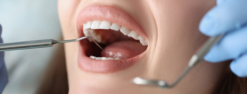 kanal tedavisi ve endodonti yapılır çenesi açık pembe dudakların içerisinde bulunan dişlerde