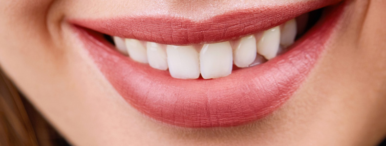 Gülüş Tasarımı, Hollywood Smile (Gülüş Estetiği) tedavisi yapılır dişlerine hastanın.