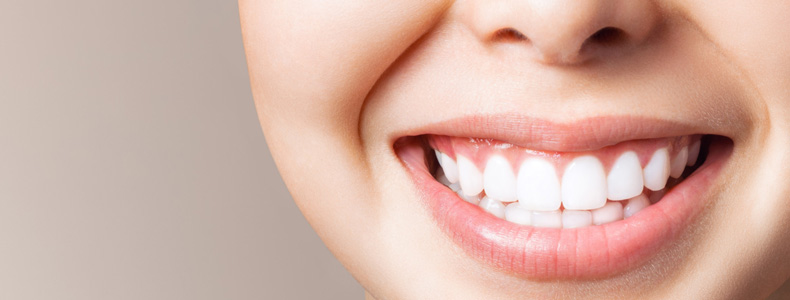 Gülüş Tasarımı, Hollywood Smile (Gülüş Estetiği) tedavisi yapılır gülen hastanın dişlerine.
