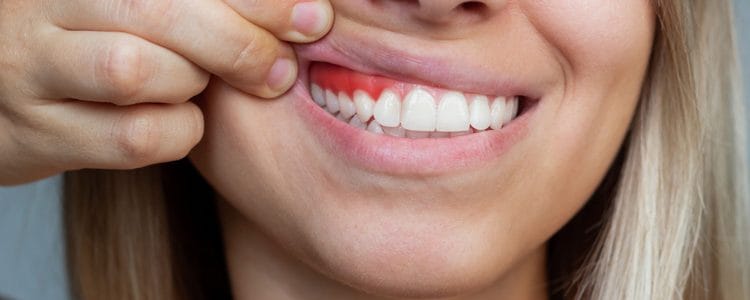 dis-eti-hastaliklari-tedavisi-periodontoloji-1-750x300 dis eti hastaliklari tedavisi periodontoloji 1 750x300 1