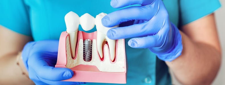 implant-dis-redent-klinik-ankara implant dis redent klinik ankara