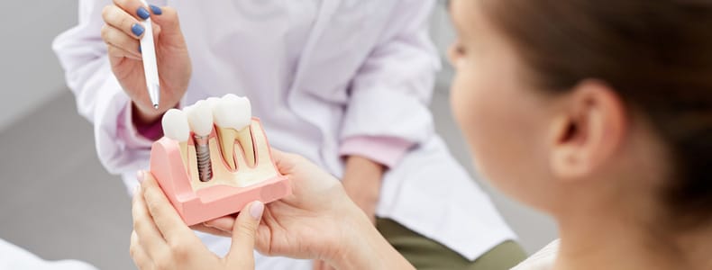 14 Soruda İmplant Diş Tedavisi Hakkında Merak Edilenler 8 İmplant diş maketi bulunur elinde kalem olan doktorun elinde.