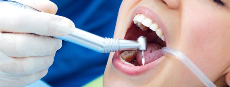 14 Soruda İmplant Diş Tedavisi Hakkında Merak Edilenler 6 implant diş tedavisi yapılır ağzı açık olan kadının dişlerinde.