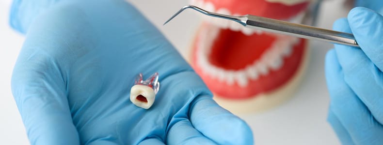 kanal-tedavisi-endodonti-redent-klinik-ankara kanal tedavisi endodonti redent klinik ankara