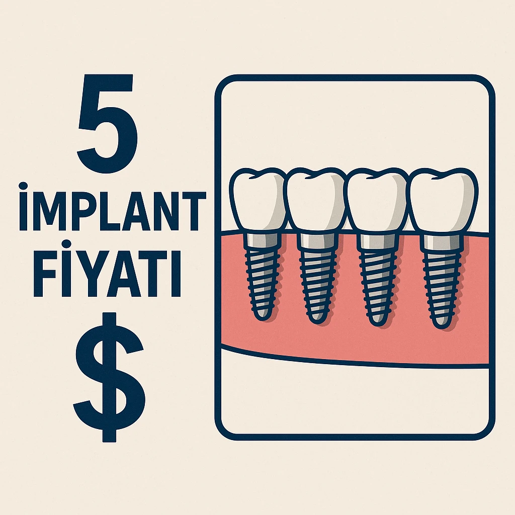 5 İmplant Fiyatı 2025: Güncel Maliyet Rehberi 5 5 implant fiyatı simgesi içeren çizim – diş hekimliği ve implant tedavisi temalı