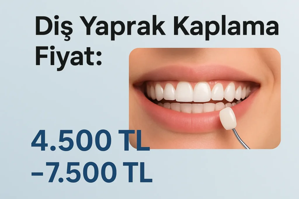 Diş Yaprak Kaplama Fiyat 2025: Ne Kadar Ödemelisiniz? 4 dis yaprak kaplama fiyat