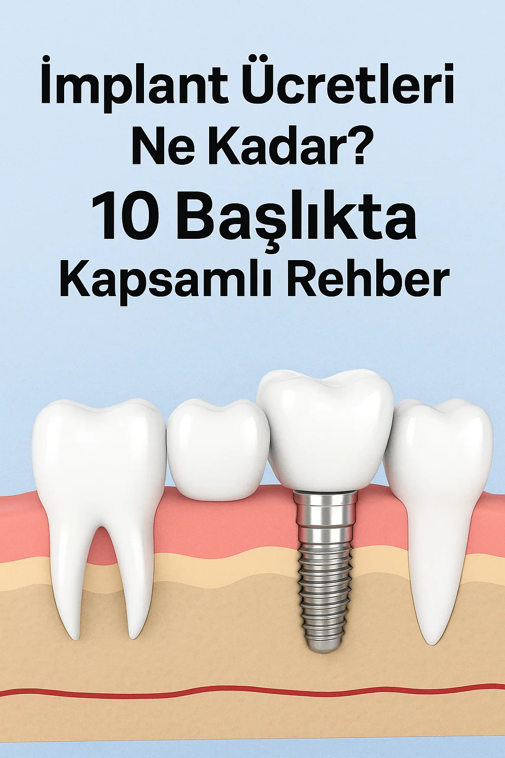 implant ucretleri ne kadar