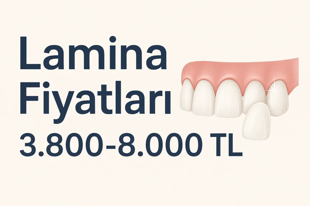 Lamina Fiyatları 2025: Türkiye’de Güncel Durum 4 lamina fiyatlari