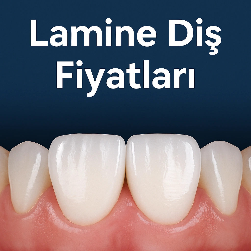 Lamine Diş Fiyatları 2025: Ne Kadar Ödemeniz Gerekiyor? 4 lamine dis fiyatlari