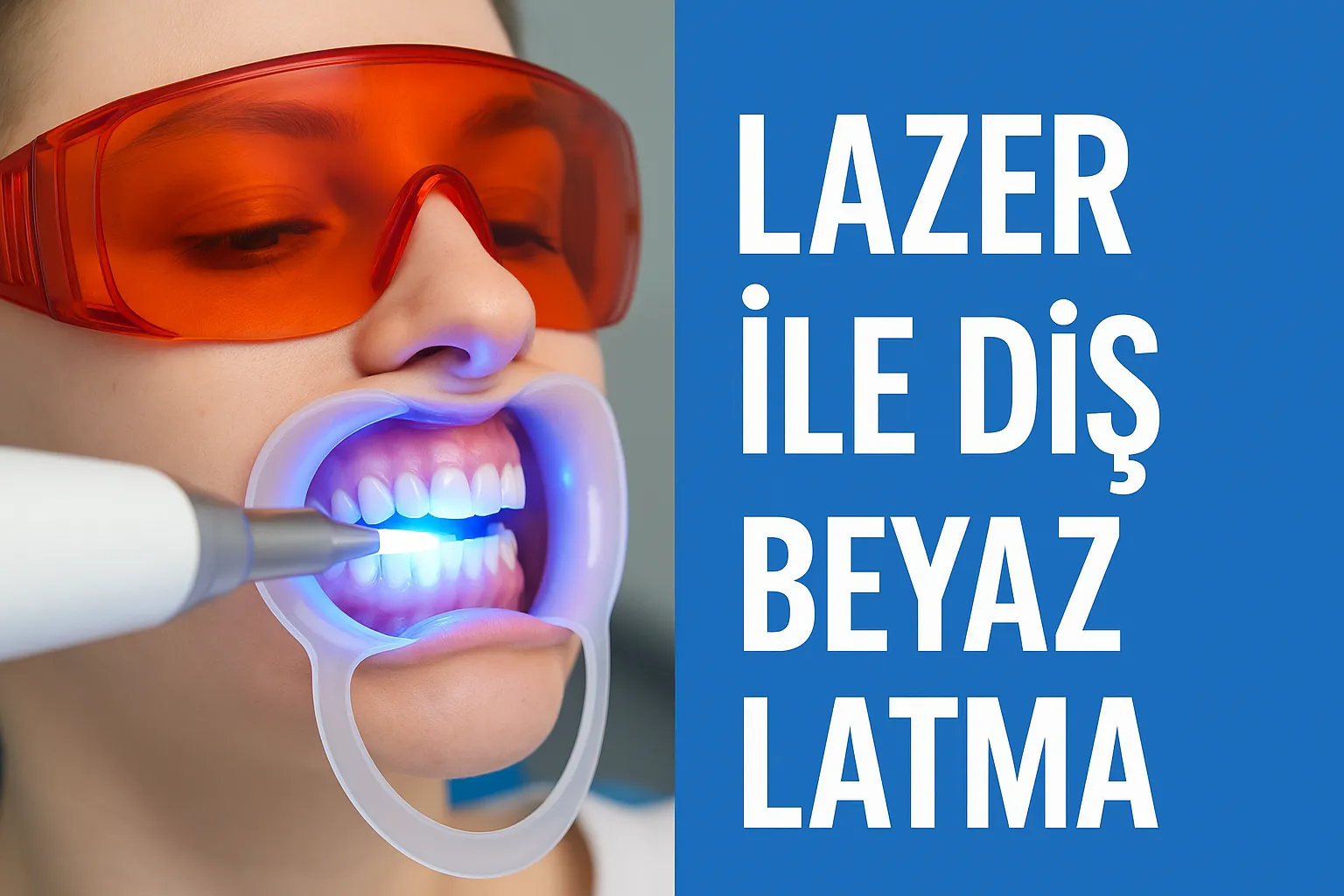 Lazer ile Diş Beyazlatma Nedir? Etkileri ve Süreci 5 lazer ile dis beyazlatma