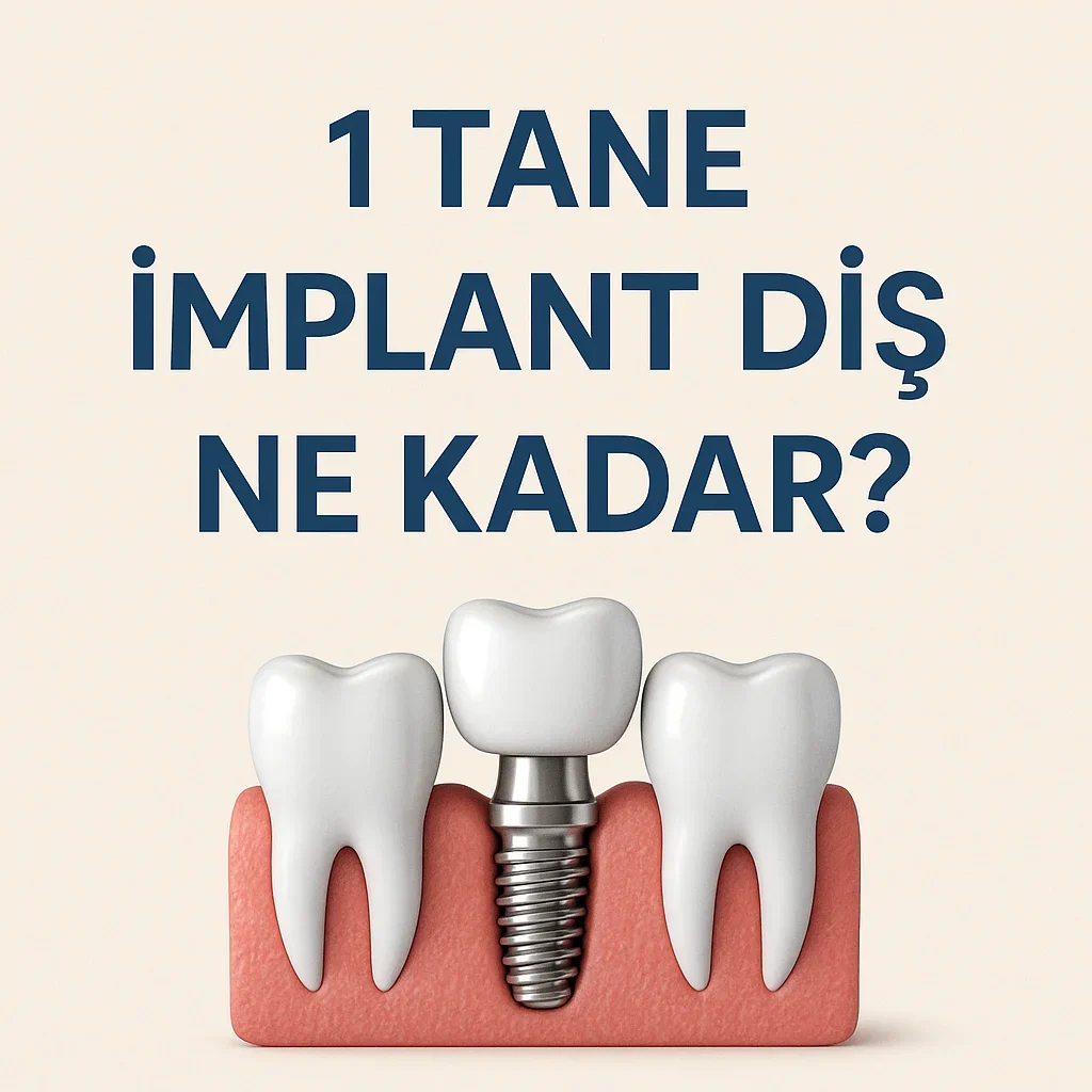 1 Tane İmplant Diş Ne Kadar? 2025 Fiyatlarına Genel Bakış 5 1 tane implant dis ne kadar