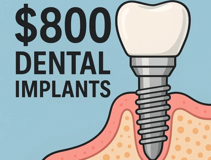 $800 dental implants
