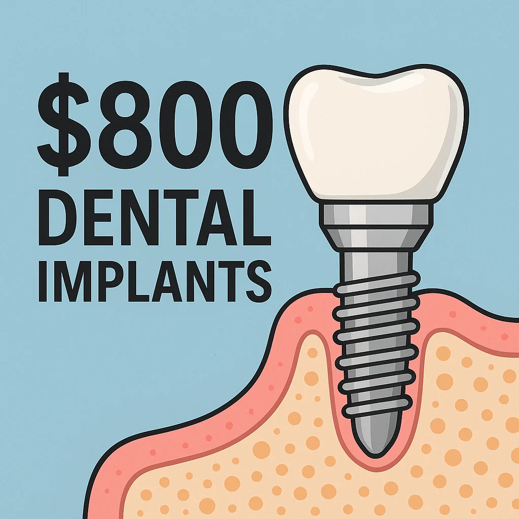 $800 Dental Implants: What You Need to Know 5 $800 dental implants