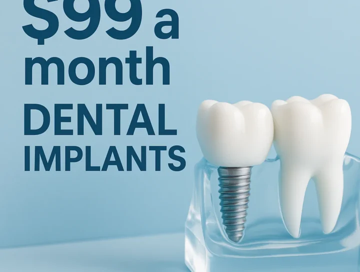 $99 a Month Dental Implants: Affordable Smile Solutions 20 $99 a month dental implants