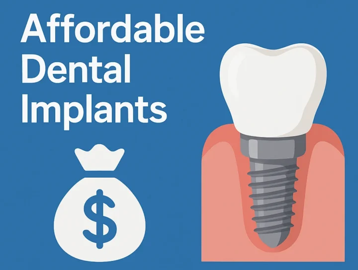 Affordable Dental Implants: Your Complete Guide to Quality & Savings 8 affordable dental implants