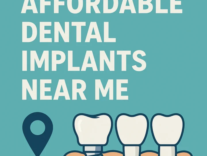 Affordable Dental Implants Near Me: Your Complete Guide 16 affordable dental implants near me