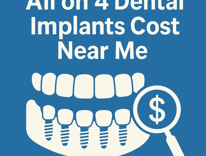 all on 4 dental implants cost near me