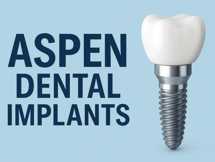 Aspen Dental Implants: Everything You Need to Know 16 aspen dental implants