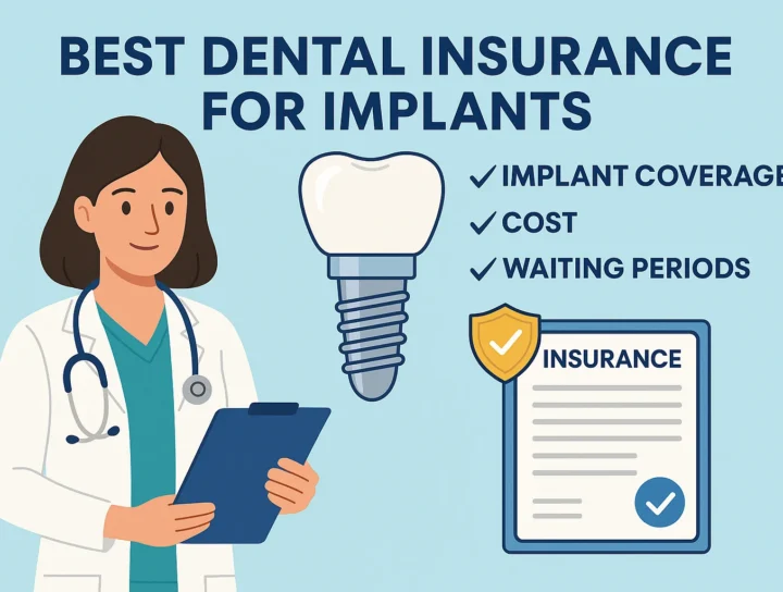 Best Dental Insurance for Implants: Top 9 Plans in 2025 16 best dental insurance for implants