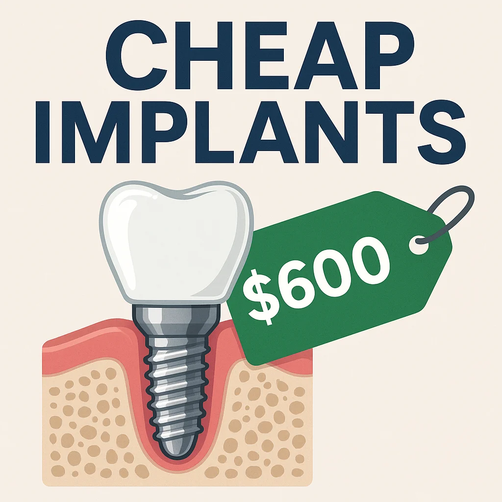 Everything You Need to Know About Cheap Implants 5 cheap implants