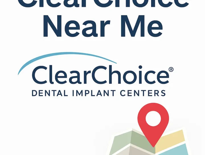 ClearChoice Near Me: Your Local Guide to Dental Implants 4 clearchoice near me