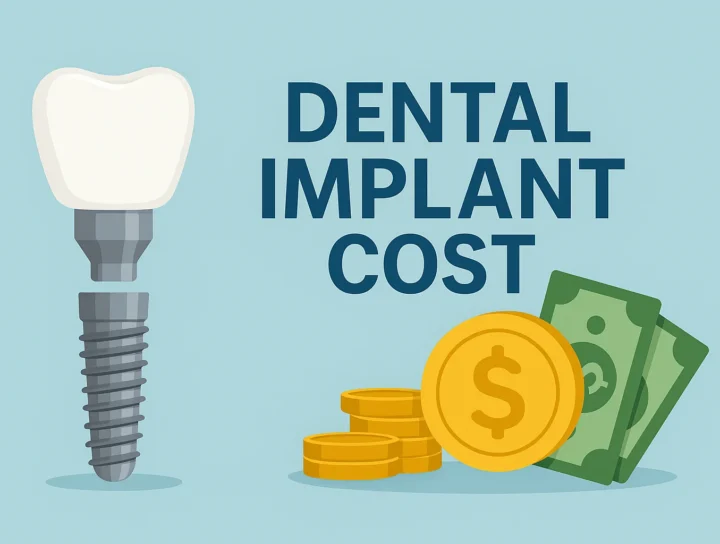 Dental Implant Cost: What You Need to Know in 2025 4 dental implant cost