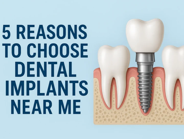 Dental Implants Near Me: Your Complete Guide 12 dental implants near me