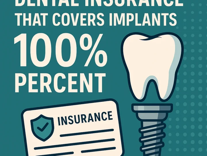 dental insurance that covers implants 100 percent