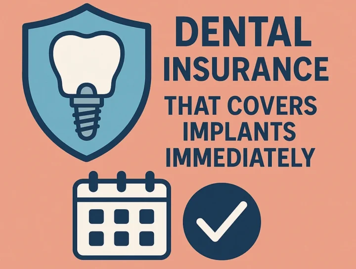 Dental Insurance That Covers Implants Immediately 4 dental insurance that covers implants immediately