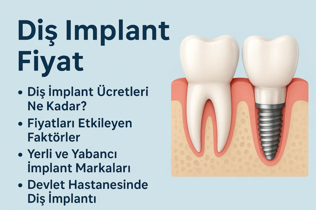 Diş İmplant Fiyat 2025: Güncel Bilgiler ve Tavsiyeler 4 dis implant fiyat