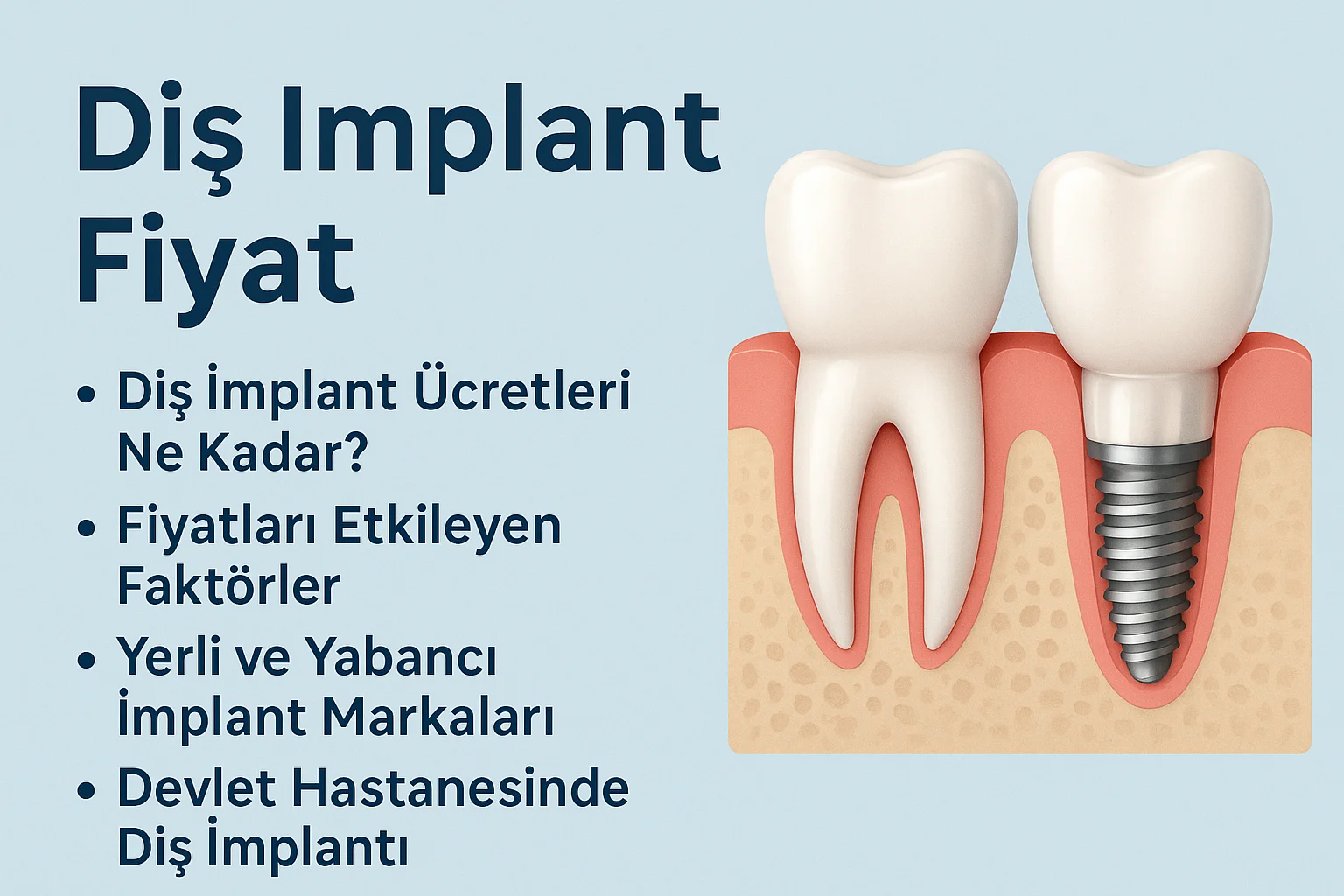 Diş İmplant Fiyat 2025: Güncel Bilgiler ve Tavsiyeler 5 dis implant fiyat