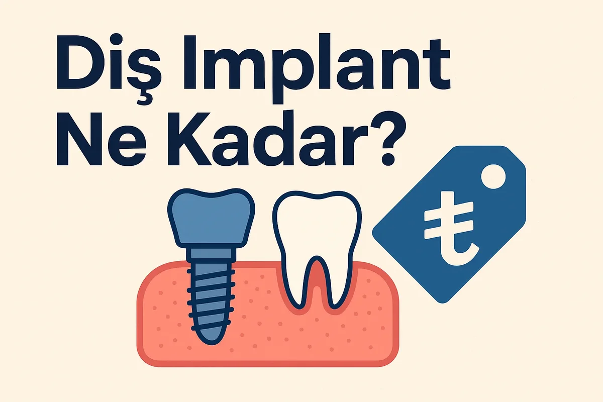 Diş İmplant Ne Kadar? 2025 Güncel Fiyat Rehberi 7 dis implant ne kadar