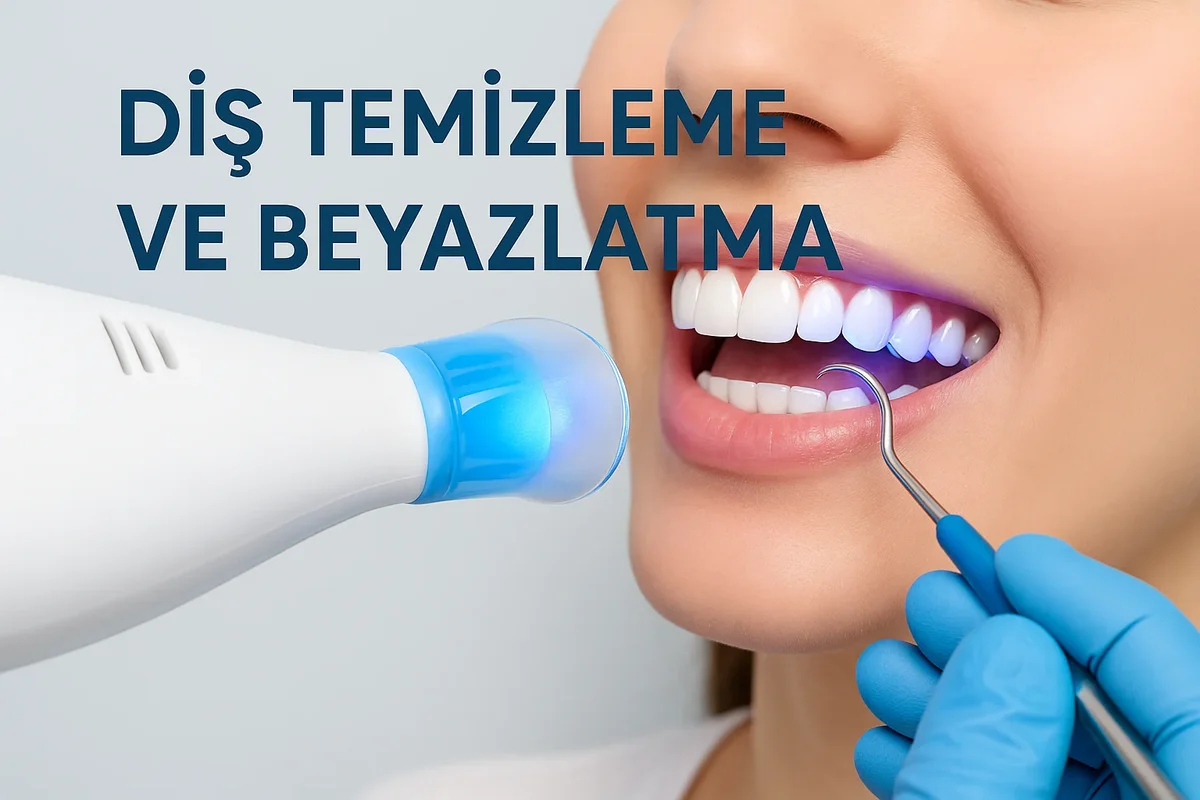 Diş Temizleme ve Beyazlatma Nedir? 5 dis temizleme ve beyazlatma