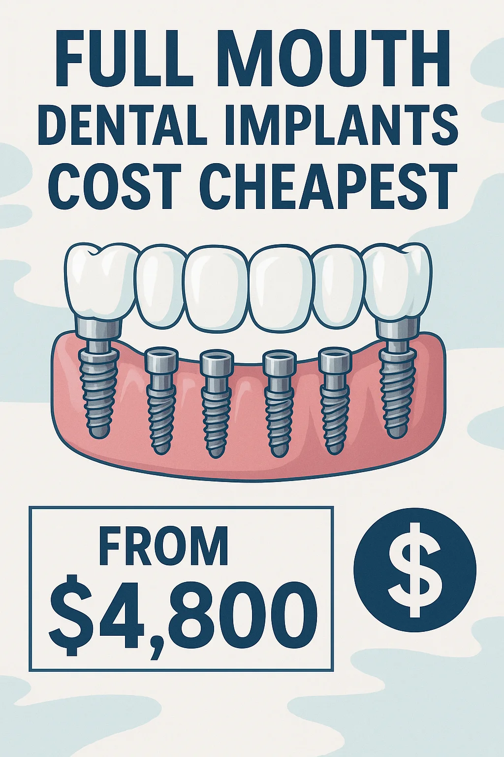 Full Mouth Dental Implants Cost Cheapest: What You Must Know 5 full mouth dental implants cost cheapest
