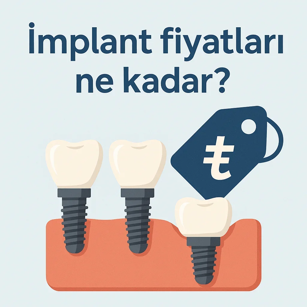 İmplant Fiyatları Ne Kadar? Türkiye 2025 Güncel Rehberi 7 implant fiyatlari ne kadar