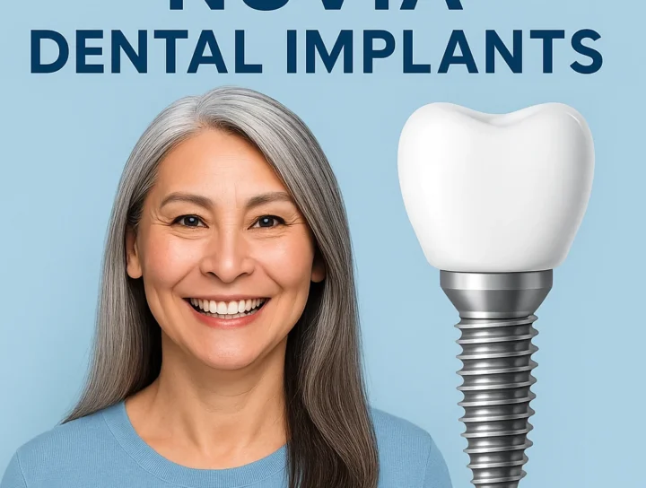 nuvia dental implants