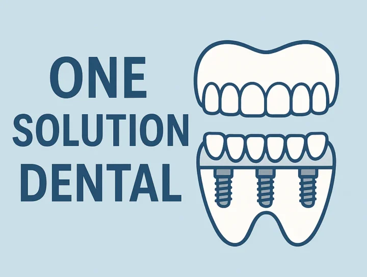 One Solution Dental: The Future of Full Smile Restoration 16 one solution dental