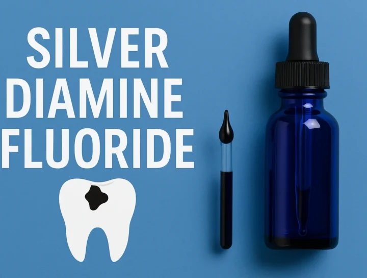 silver diamine fluoride
