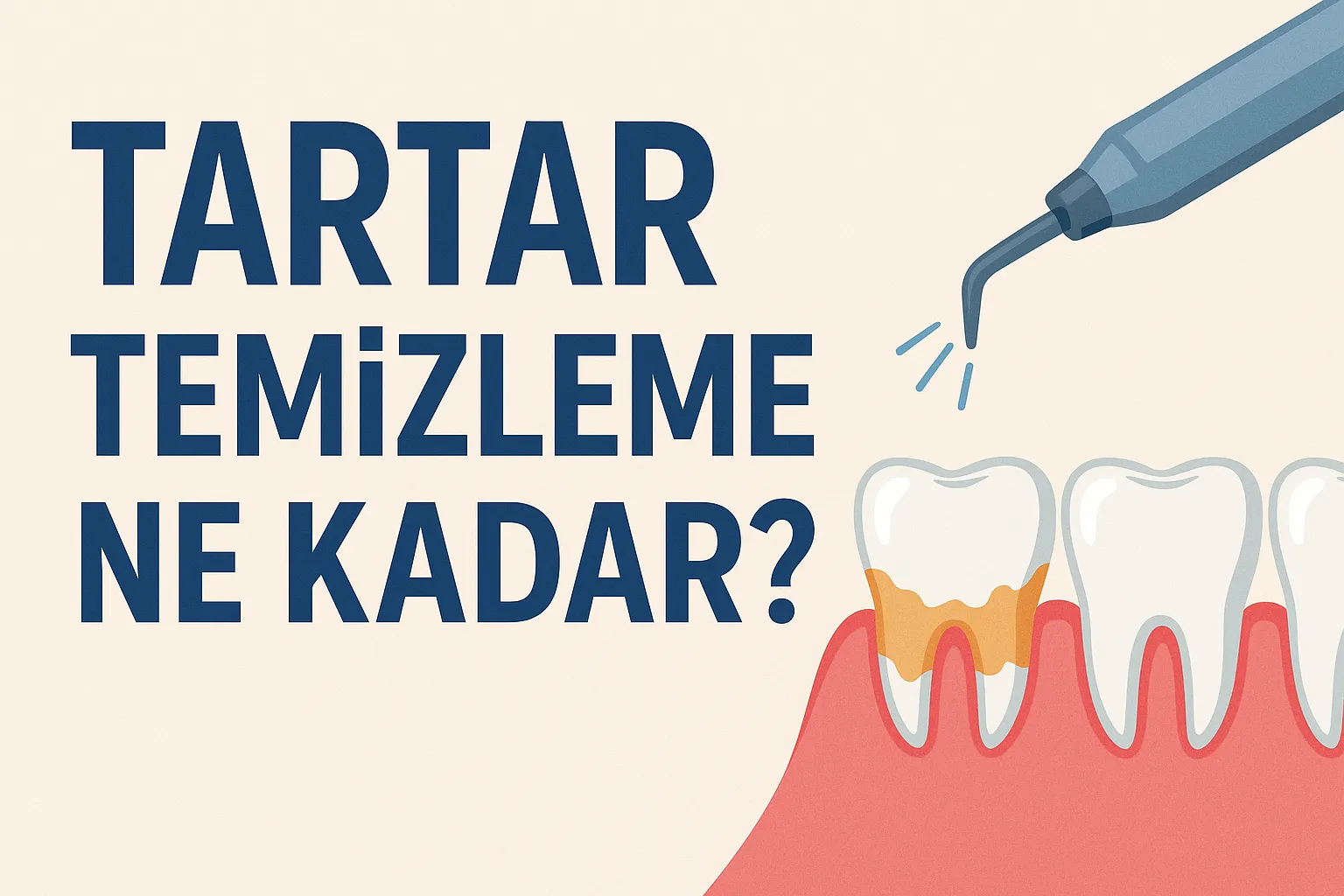 2025’te Tartar Temizleme Ne Kadar? Detaylı Rehber 7 tartar temizleme ne kadar