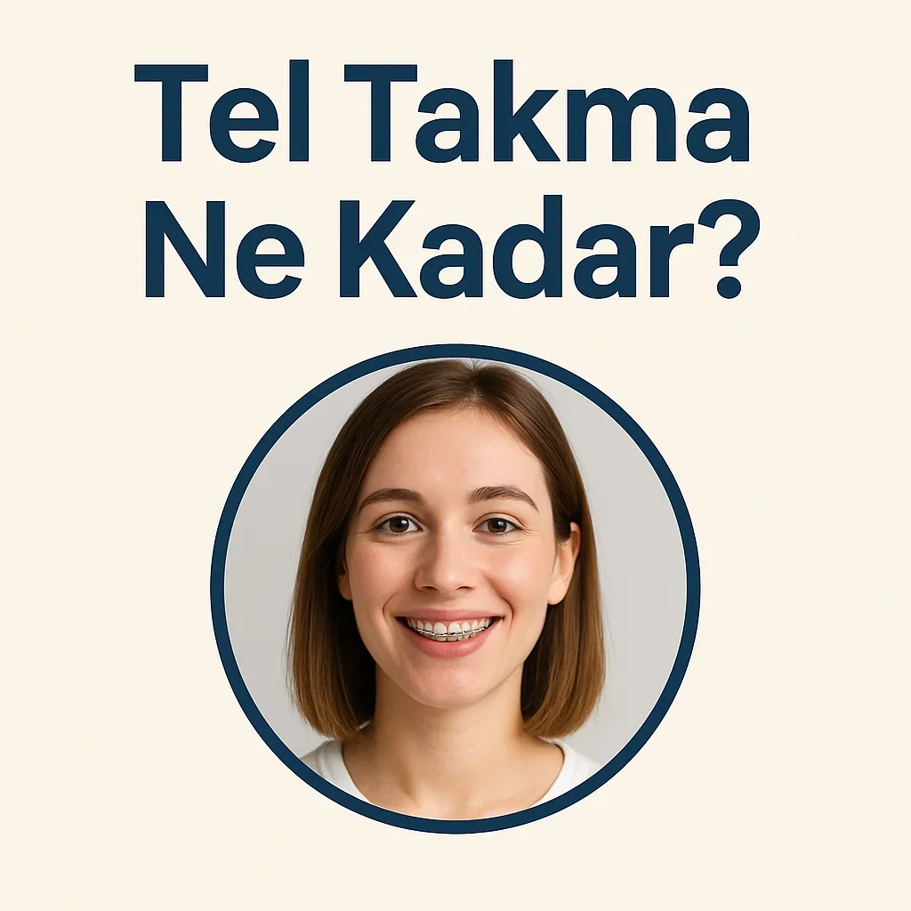 Tel Takma Ne Kadar? Güncel Fiyatları ve Etkileyen Faktörler 5 tel takma ne kadar