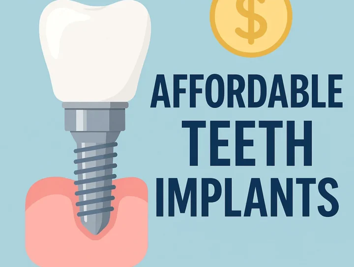 affordable teeth implants