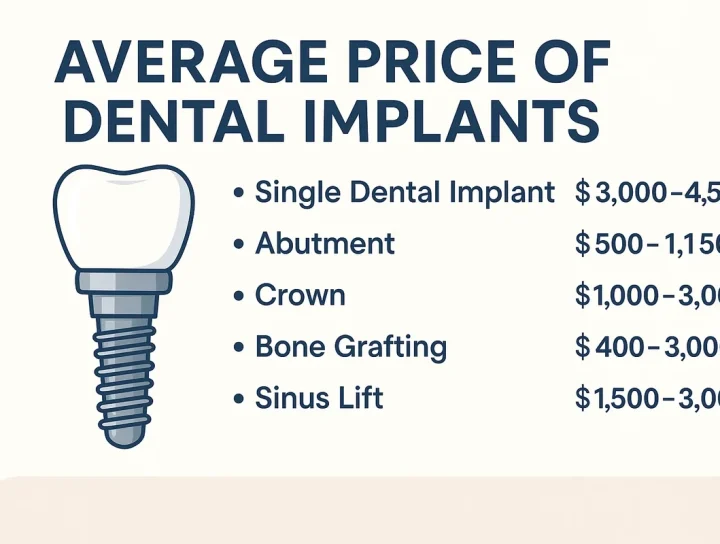 average price of dental implants