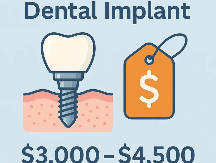 Cost of One Dental Implant: 2025 Pricing Breakdown & Insights 16 cost of one dental implant