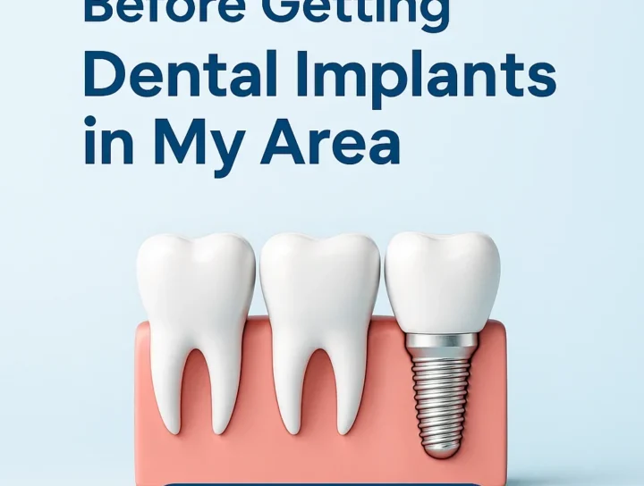 Top Benefits of Getting Dental Implants in My Area 20 dental implants in my area