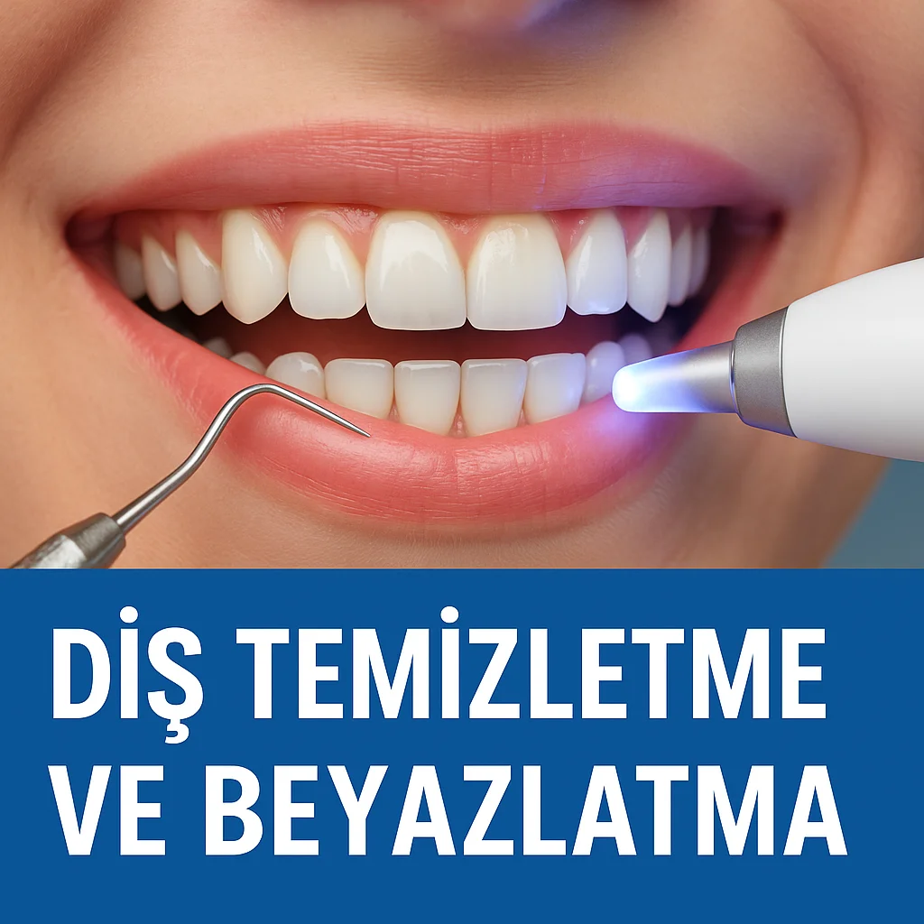 Diş Temizletme ve Beyazlatma: Sağlıklı Bir Gülüşün Sırrı 5 dis temizletme ve beyazlatma