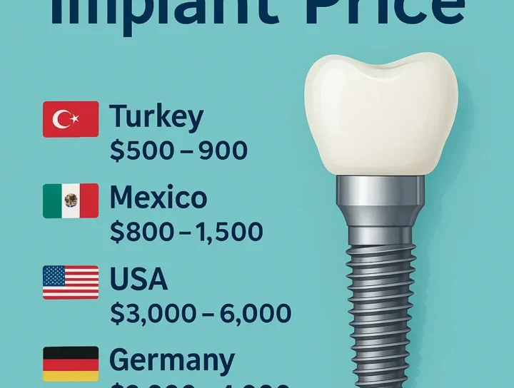 Implant Price Guide: Global Costs and Key Insights 12 implant price