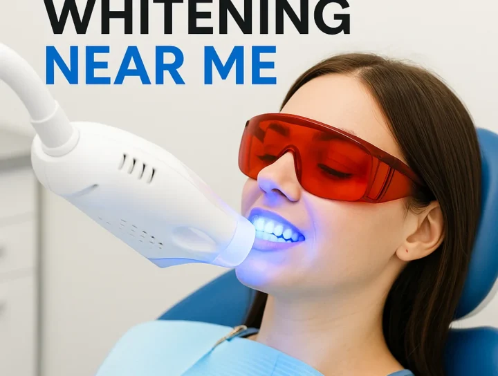 Top 10 Reasons to Choose Laser Teeth Whitening Near Me 4 laser teeth whitening near me