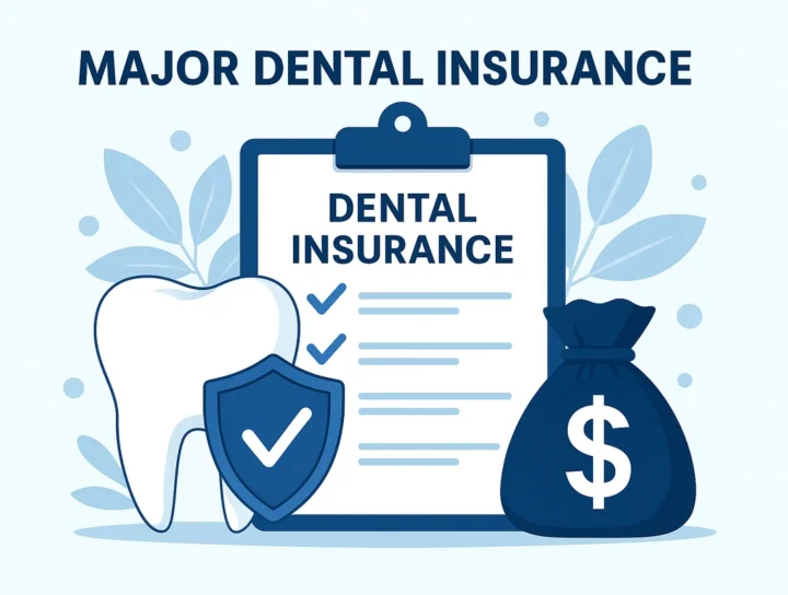 major dental insurance