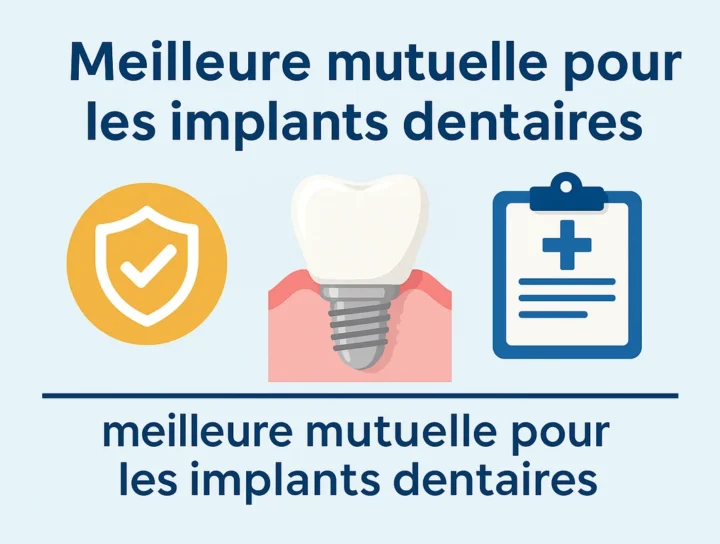 Quelle est la meilleure mutuelle pour les implants dentaires ? 4 meilleure mutuelle pour les implants dentaires